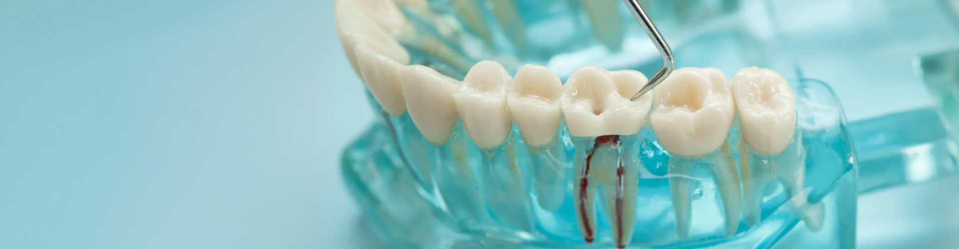 Dental tool examining a tooth model to demonstrate a professional root canal procedure.